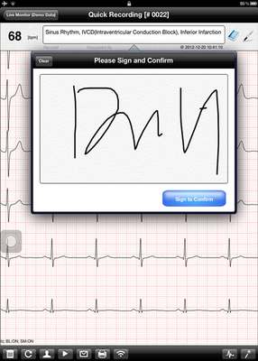 12 channel Digital ECG Machine