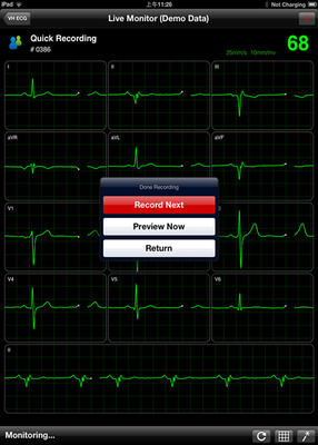 12 channel Digital ECG Machine