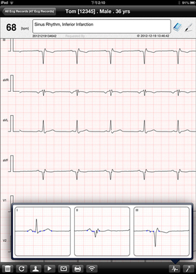 12 channel Digital ECG Machine
