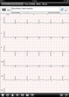 12 channel Digital ECG Machine