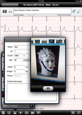 Mobile Wireless ECG Machine Portable iPad ECG Heart Rate Monitor