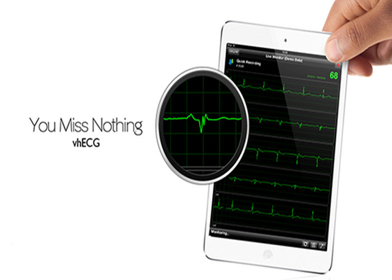 Cardiac Stress System 12 channel Digital ECG Machine , Hand Held ECG