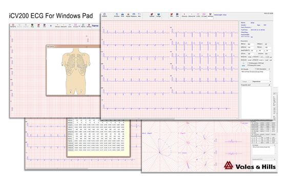 Wireless pc based resting ecg Device Bluetooth For Winpad iCV200